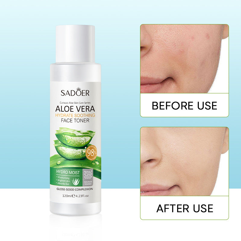Aloe Vera Hydrating Soothing Toner Moisturizing Moisturizing Lifting Rejuvenation Toner