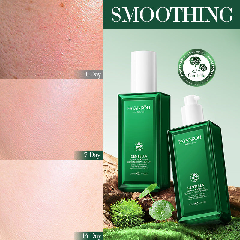 All English FAYANKOU Centella Soothing Repair Serum, Hydrating and Moisturizing Water Milk