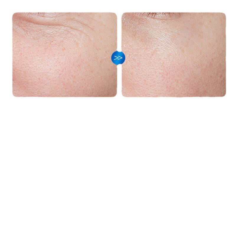 8D Hyaluronic Acid Anti-Wrinkle Ampoule Serum, Firming Serum