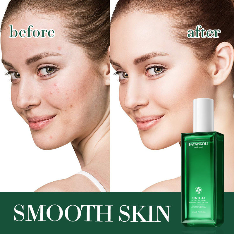 All English FAYANKOU Centella Soothing Repair Essence Water, Hydrating Moisturizing Water