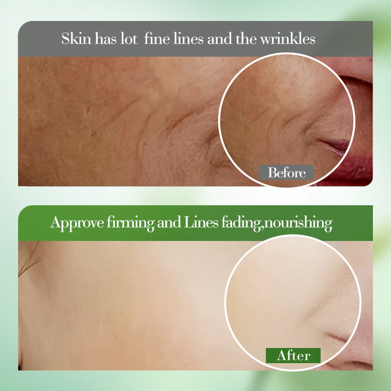 Aloe Vera Hydrating Soothing Cream, Moisturizing Skin Moisturizing Cream