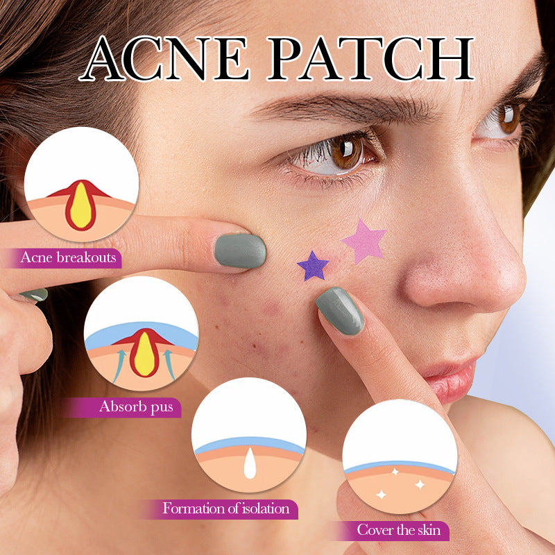 Acne repair stickers, colored acne stickers, students remove acne