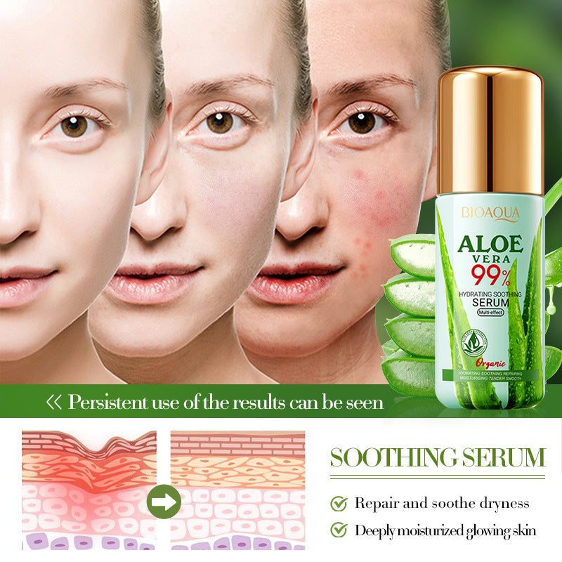 Aloe Vera Hydrating Soothing Serum, Hydrating Moisturizing Moisturizing Essence