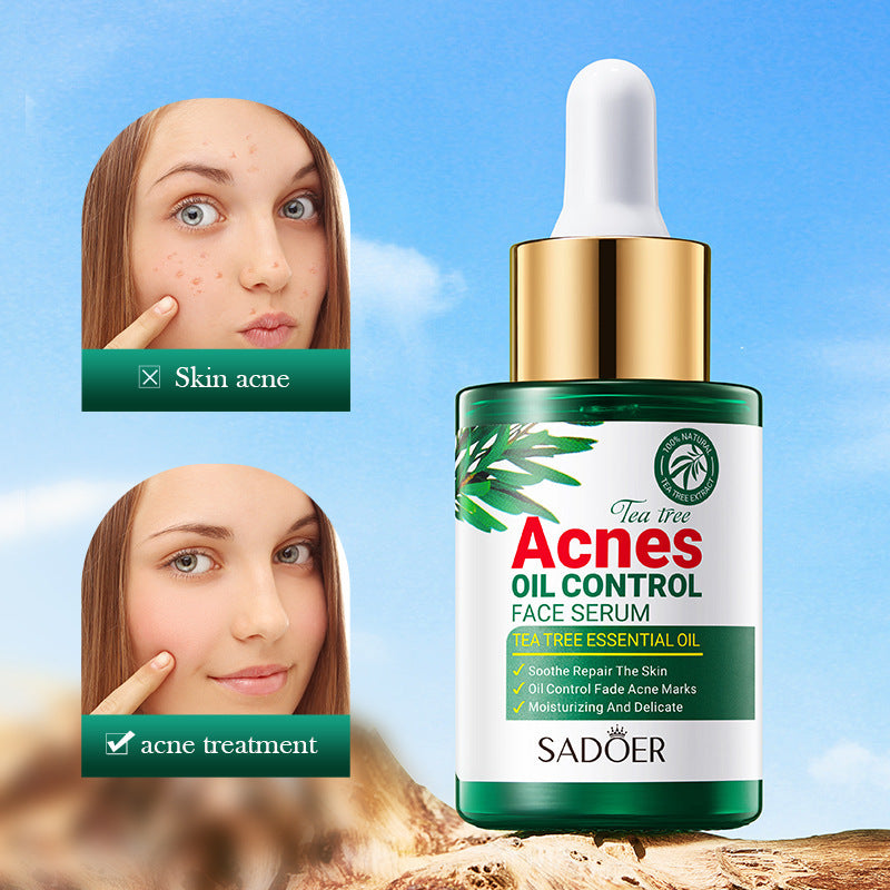 Acne Serum Acne Mark Skin Care Products Hydrating Facial Anti-Acne Serum