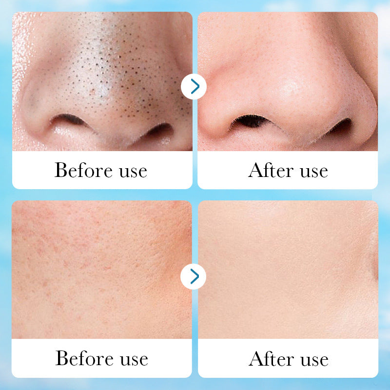 Aloe Vera Pore Clear Solid Mask, Cleansing Facial Mud Mask