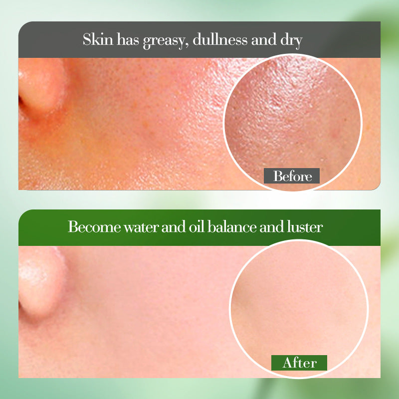 Aloe Vera Hydrating Soothing Lotion, Moisturizing and Firming Skin Water Lotion