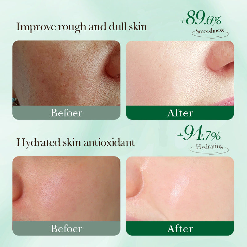 Aloe Vera Repair and Rejuvenation Lyophilized Powder Combination Lyophilized Powder for Sensitive Skin