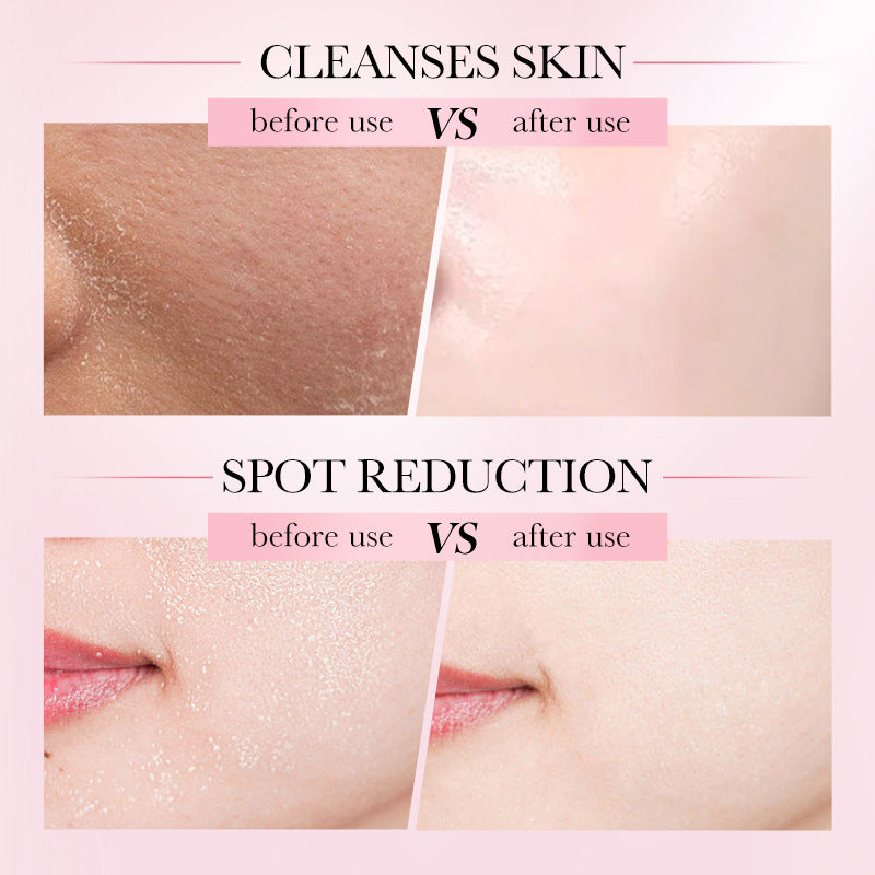 4-in-1 Facial Multi-effect Cleansing Mousse Cleansing Foam Facial cleanser  Wholesale