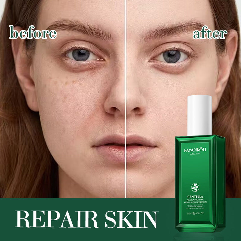 All English FAYANKOU Centella Soothing Repair Serum, Hydrating and Moisturizing Water Milk